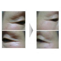 Антивозрастная сыворотка для лица LIOELE Power Wrinkle Solution - вид 1 миниатюра