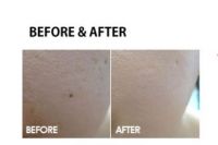ББ в компактной упаковке/пудра SKIN79 Sun Protect Beblesh Pact - вид 4 миниатюра